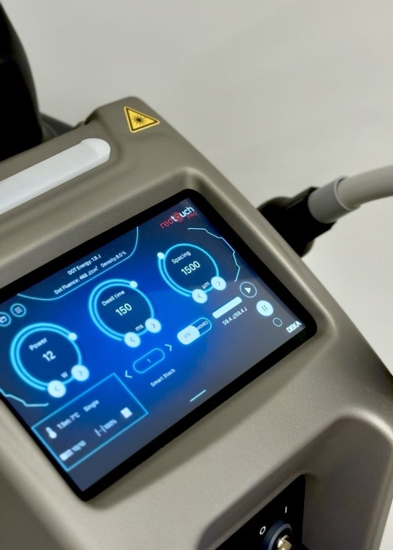 Laser Red Touch Pro - okładka usługi